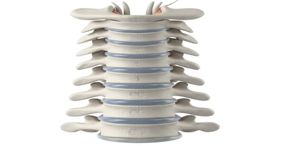 Boyun Fıtığı Ameliyatı: ACDF ve PCF Yöntemleri Arasında Farklar